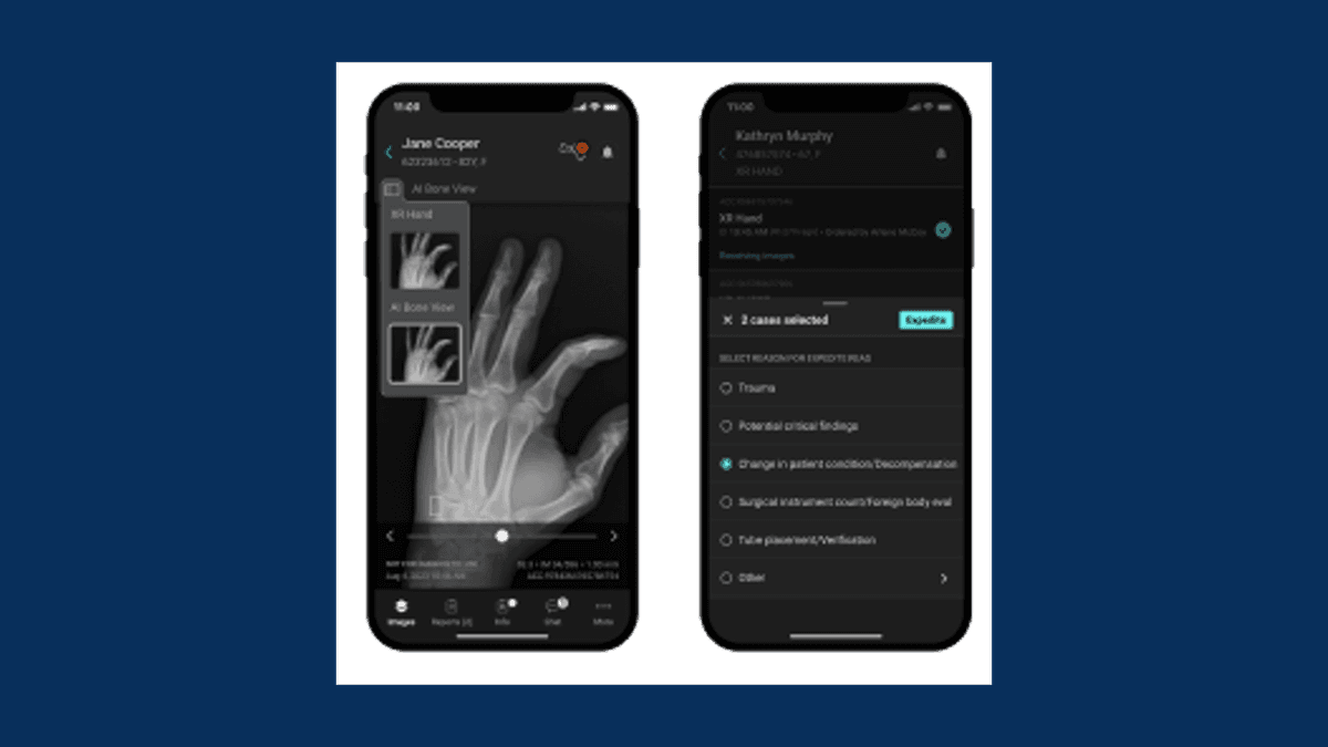 Aidoc cover image